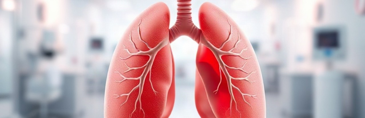 Akciğer kanserinde KRAS G12D’ye protein yıkıcı: Setidegrasib Faz 3’te
