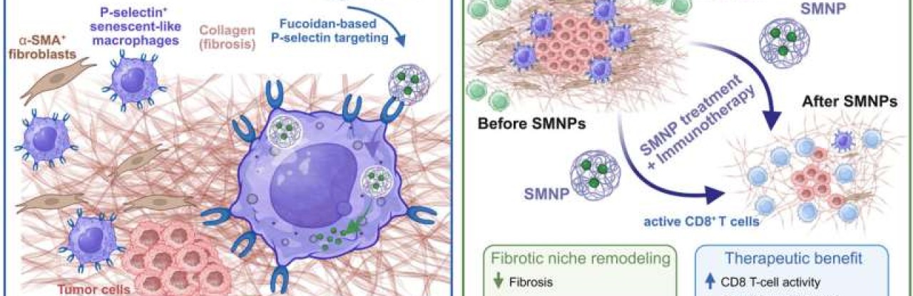 Nanopartiküller Tümörün Kalkanını Yıkıyor: İmmünoterapi Direnci Aşıldı