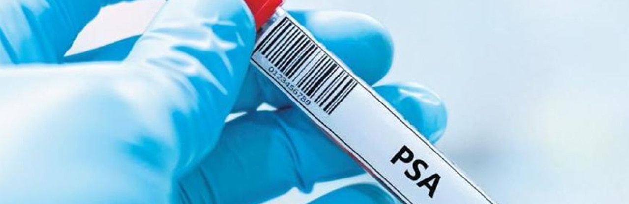 Prostat Kanserinde Aile Öyküsü ve PSA Testi Hayat Kurtarıyor
