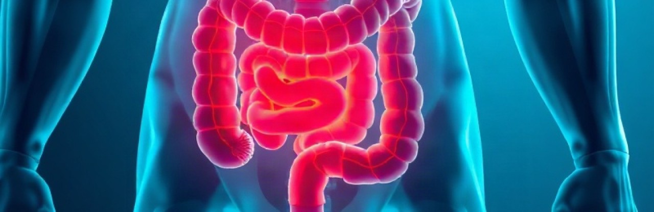 Bagirsak Kanserinde Ameliyat Oncesi Immunoterapi: 33 Ayda Sifir Nuks