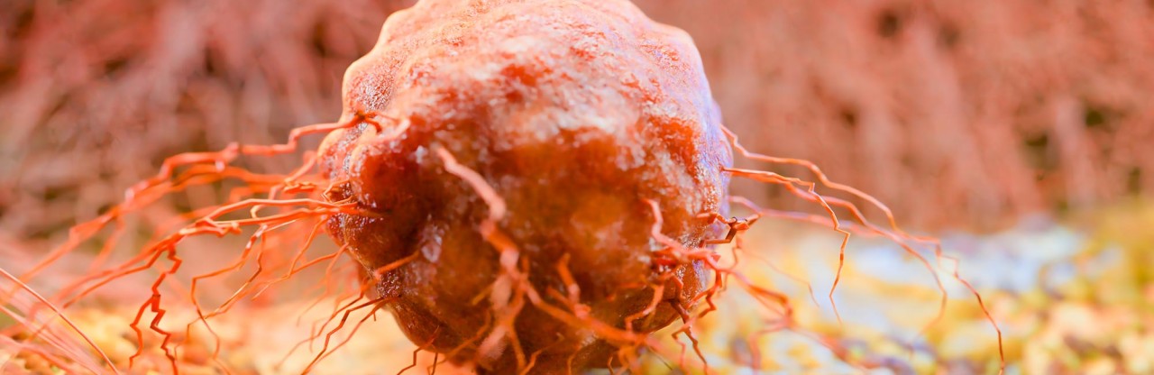Kanserde mikrobiyom atılımı: Mayo Clinic Cell çalışması