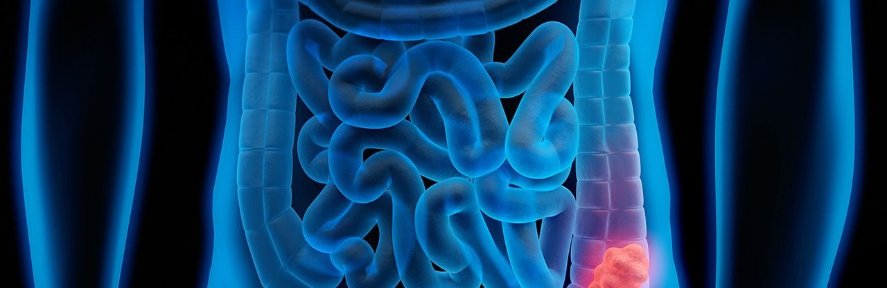 Kolon ve Akciğer Kanserinde FDA’dan Çift Atılım: Temab-A