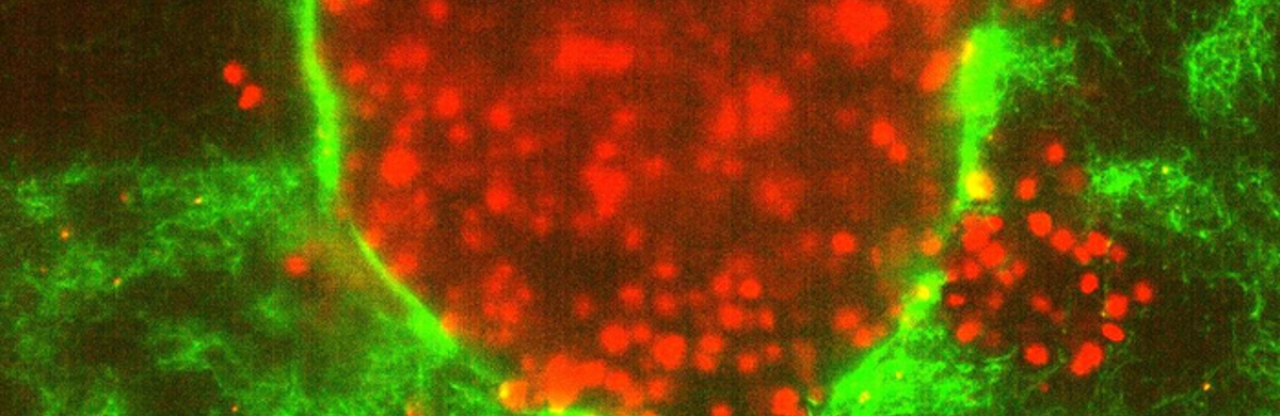 Küçük Kanser Hücreleri En Agresif Olanı: Virginia Tech Keşfi
