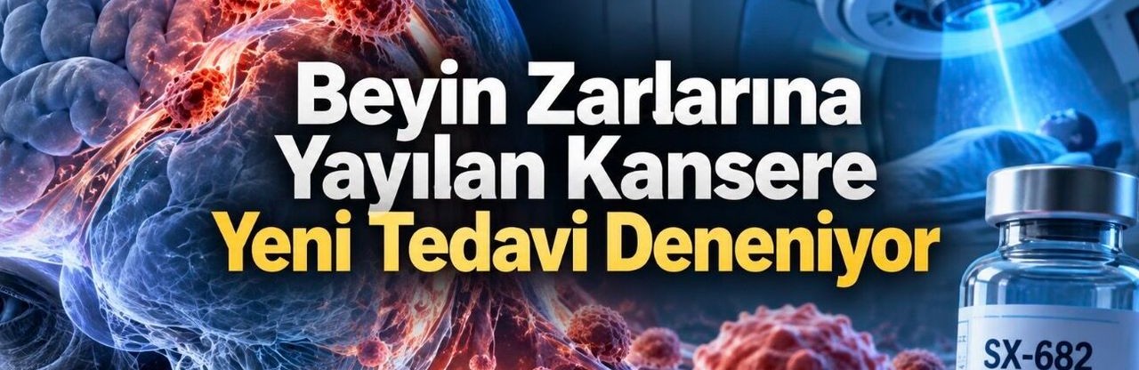 Leptomeningeal Metastazda SX-682 ile Radyoterapi Direnci Aşılıyor