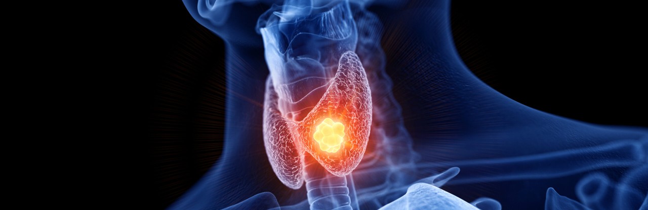 Tiroit Kanserinde Selpercatinib Atılımı: Ölüm Riski Yüzde 66 Düştü