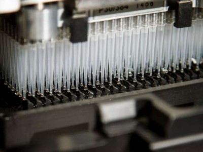 Çocukluk lösemisinde kalıtsal genetik risk: Karolinska çalışması