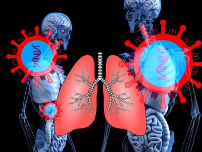 Küçük hücreli akciğer kanserinde moleküler kalkan çöktü