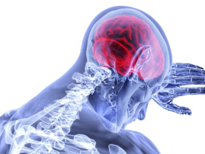 Küçük hücreli akciğer kanserinde radyocerrahi sağkalımı ikiye katladı