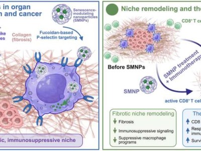 Nanopartiküller Tümörün Kalkanını Yıkıyor: İmmünoterapi Direnci Aşıldı