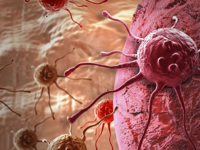 PAPILLON akciğer kanserinde rekor sağkalım: Amivantamab 34,3 ay