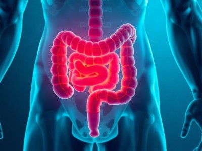 Bagirsak Kanserinde Ameliyat Oncesi Immunoterapi: 33 Ayda Sifir Nuks