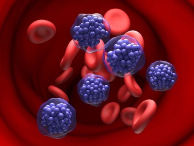 DLBCL Lenfomada Pola-R-GemOx Sağkalımı 19.5 Aya Çıkardı: POLARGO Faz 3