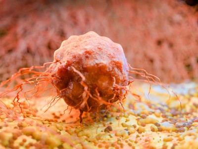 Kanserde mikrobiyom atılımı: Mayo Clinic Cell çalışması