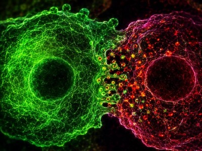 Pankreas Kanserinde ANO6 Hedefi: Tümör Beslenmesi Kesildi