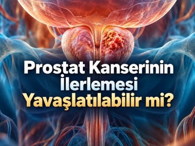 Prostat kanserinde beslenme ve egzersiz tumor ilerlemesini yavaslatiyor mu?
