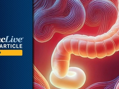 Rektal kanserde dostarlimab atılımı: Cerrahisiz tam yanıt yüzde 71