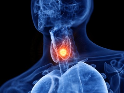 Tiroit Kanserinde Selpercatinib Atılımı: Ölüm Riski Yüzde 66 Düştü