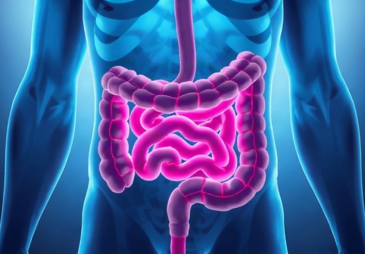 Kolorektal Kanserde CAR T Hücre Tedavisine FDA Onayı