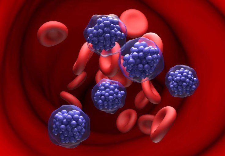 DLBCL Lenfomada Pola-R-GemOx Sağkalımı 19.5 Aya Çıkardı: POLARGO Faz 3