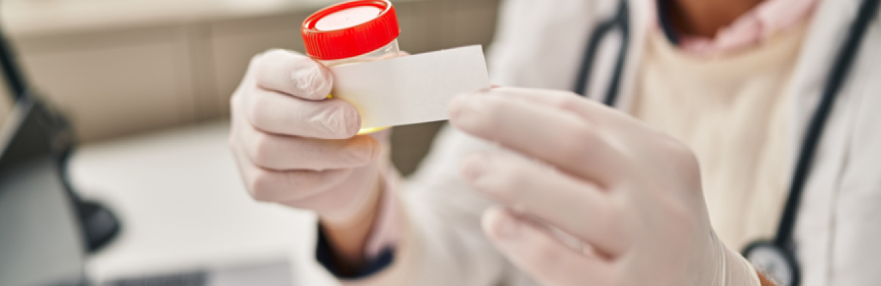Mesane kanserinde evde test dönemi: İdrar testi yüzde 92 başarı gösterdi