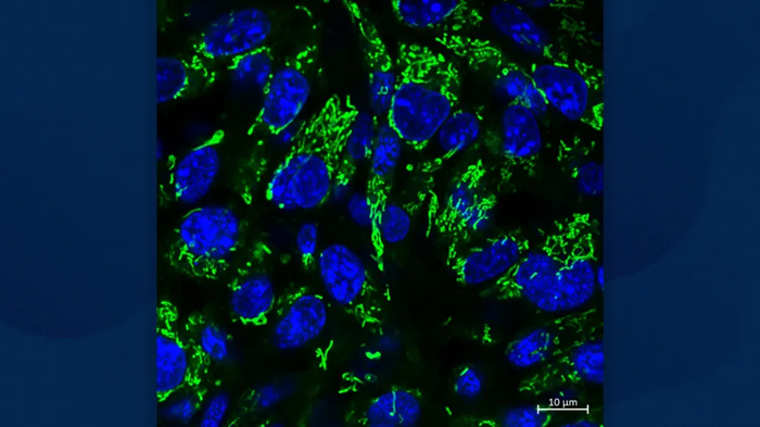 mIDH1 gliom hücrelerinde mitokondri (yeşil) görüntüsü