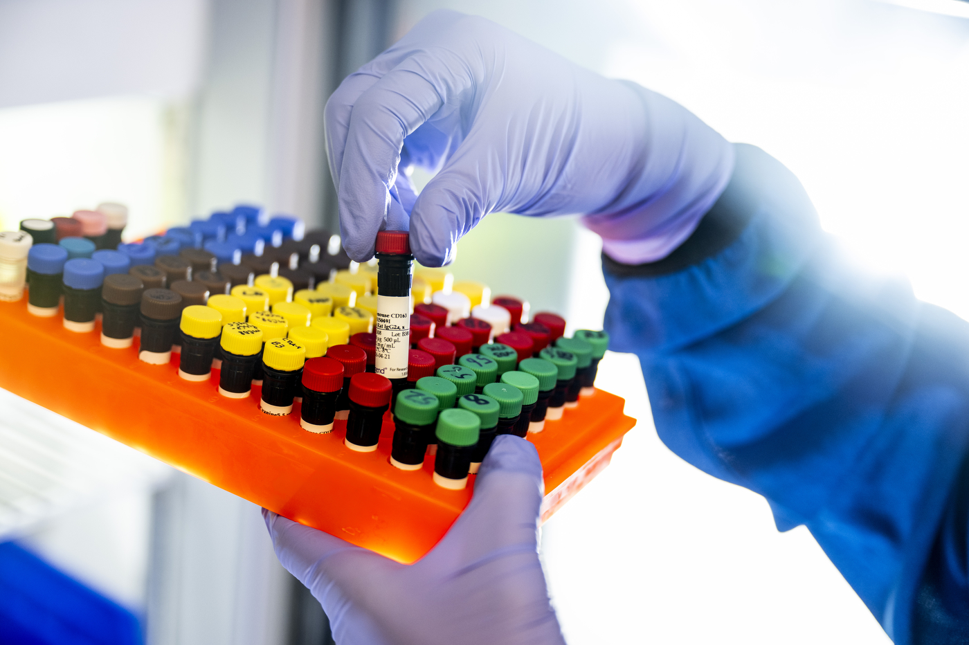 Laboratuvarda pipetle örnek hazırlayan araştırmacı — oksijen üreten kanser aşısı çalışması