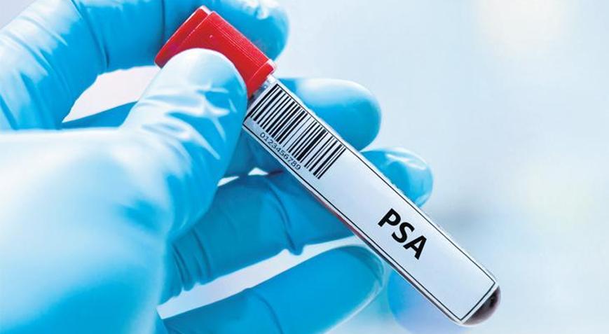 Prostat kanseri taraması ve PSA testi