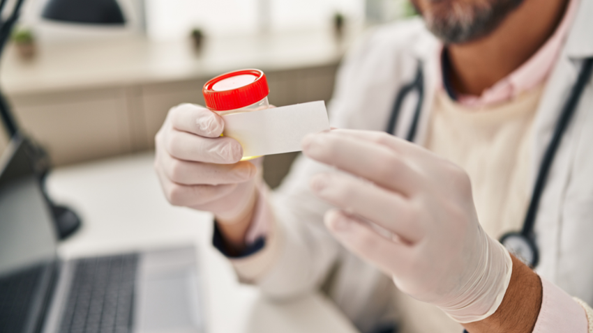 Mesane kanserinde evde test dönemi: İdrar testi yüzde 92 başarı gösterdi