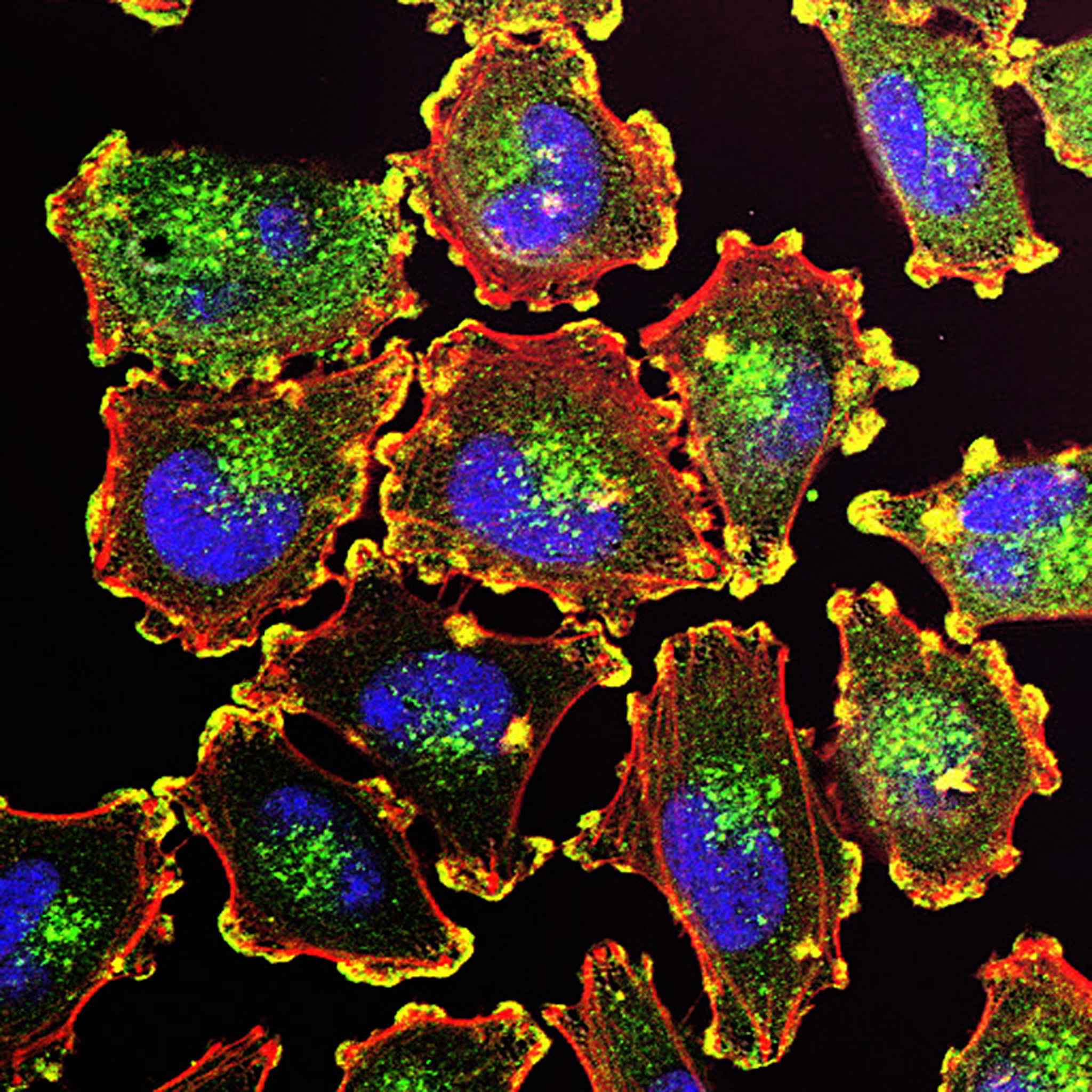 mRNA kanser aşısı ve melanom tedavisi